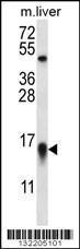 Anti-MYCBP Rabbit Polyclonal Antibody (APC (Allophycocyanin))