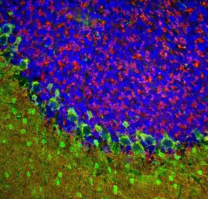 Antibody anti-beta SYNUCLEIN 100 µl