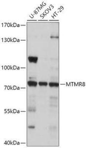 Anti-MTMR8 antibody