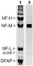 Anti-NEFM Mouse Monoclonal Antibody [clone: 3H11]