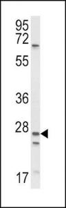 Anti-SCNN1A Rabbit Polyclonal Antibody (AP (Alkaline Phosphatase))