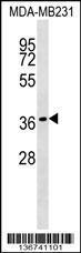 Anti-HEYL Rabbit Polyclonal Antibody (PE (Phycoerythrin))