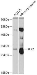 Western blot analysis of extracts of various cell lines, using Anti-Kallikrein 2/KLK2 Antibody (A9122) at 1:3,000 dilution The secondary antibody was Goat Anti-Rabbit IgG H&L Antibody (HRP) at 1:10,000 dilution Lysates/proteins were present at 25 µg per lane