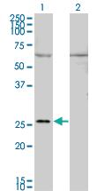 Anti-GAP43 Mouse Monoclonal Antibody [clone: 3C11]