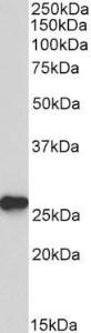 Anti-PRDX6 Antibody (A85193) (01 µg/ml) staining of Mouse Liver lysate (35 µg protein in RIPA buffer) Primary incubation was 1 hour Detected by chemiluminescence