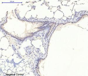 Anti-AMPK alpha 1 + AMPK alpha 2 Rabbit Polyclonal Antibody