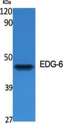 Anti-EDG6 antibody