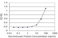 Anti-GAP43 Mouse Monoclonal Antibody [clone: 3C11]