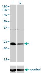 Anti-NFYB Mouse Monoclonal Antibody [clone: 6H6]