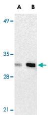 Anti-ANP32A Rabbit Polyclonal Antibody