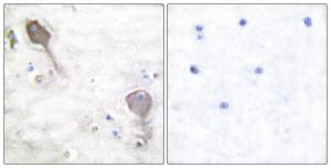 Anti-Parkin Rabbit Polyclonal Antibody