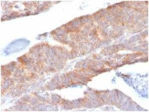 Immunohistochemical analysis of formalin-fixed, paraffin-embedded human colon tissue using Anti-IL-1 beta Antibody [IL1B/3993]