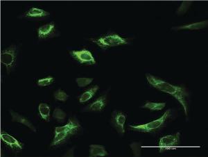 Anti-SRPK1 Mouse Monoclonal Antibody [clone: 2E8]