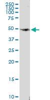 Anti-VIPR1 Rabbit Polyclonal Antibody