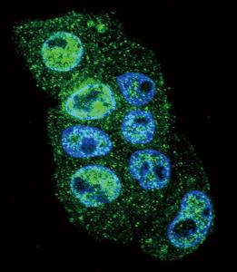 Anti-INHBA Rabbit Polyclonal Antibody (HRP (Horseradish Peroxidase))