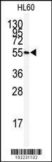 Anti-BMP9 (GDF2) Rabbit Polyclonal Antibody