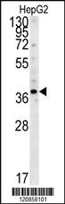 Anti-PSMD7 Rabbit Polyclonal Antibody