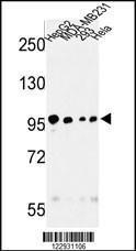 Anti-MASTL Rabbit Polyclonal Antibody (Biotin)