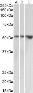 Anti-HAVCR1 Antibody (A83529) (2µg/ml) staining of Kidney (A), Testis (B) and Uterus (C) lysates (35µg protein in RIPA buffer). Primary incubation was 1 hour. Detected by chemiluminescence.