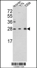 Anti-TPI1 Rabbit Polyclonal Antibody