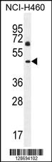 Anti-CL029 Rabbit Polyclonal Antibody