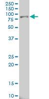 Anti-ALOX15 Mouse Monoclonal Antibody [clone: 3D8]