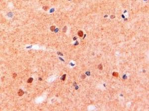 Anti-ITGAM Antibody (A83530) (2 µg/ml) staining of paraffin embedded Human Brain. Steamed antigen retrieval with Tris/EDTA buffer pH 9, HRP-staining