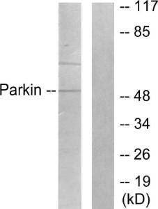 Anti-Parkin Rabbit Polyclonal Antibody