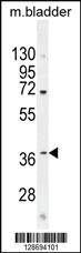 Anti-CL029 Rabbit Polyclonal Antibody