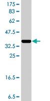 Anti-YBX3 Mouse Polyclonal Antibody