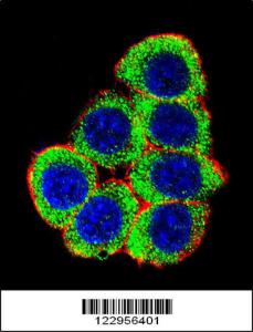 Anti-XRCC6 Rabbit Polyclonal Antibody (HRP (Horseradish Peroxidase))