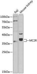 Anti-MC2-R Rabbit Polyclonal Antibody