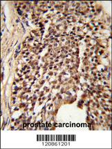 Anti-TPI1 Rabbit Polyclonal Antibody