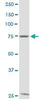 Anti-GTSE1 Rabbit Polyclonal Antibody