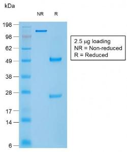 SDS-PAGE analysis of Anti-Caldesmon Antibody [rCALD1/820] under non-reduced and reduced conditions; showing intact IgG and intact heavy and light chains, respectively SDS-PAGE analysis confirms the integrity and purity of the antibody