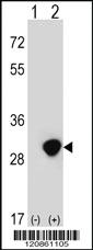 Anti-TPI1 Rabbit Polyclonal Antibody