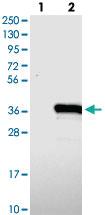 Anti-TYW3 Rabbit Polyclonal Antibody