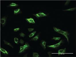 Anti-SRPK1 Mouse Monoclonal Antibody [clone: 2E8]