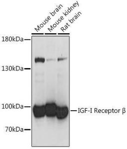 Western blot analysis of extracts of various cell lines, using Anti-IGF1 Receptor Antibody (A93242) at 1:1,000 dilution