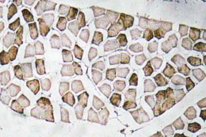 Immunohistochemical analysis of paraffin-embedded human skeletal muscle tissue using Anti-Nogo A Antibody