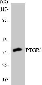 Anti-PTGR1 antibody