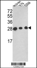 Anti-TPI1 Rabbit Polyclonal Antibody