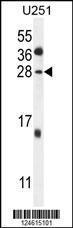 Anti-GGTLC2 Rabbit Polyclonal Antibody