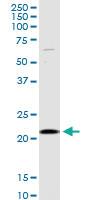 Anti-VIMP Rabbit Polyclonal Antibody