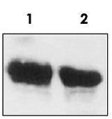 Anti-ACAT2 Mouse Monoclonal Antibody [clone: AT2.G7]