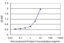 Anti-VIL1 Polyclonal Antibody Pair