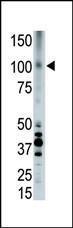 Anti-LRP8 Rabbit Polyclonal Antibody (Biotin)