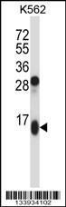 Anti-GUCA2A Rabbit Polyclonal Antibody (PE (Phycoerythrin))