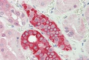 Anti-DDX41 Antibody (A85195) (5 µg/ml) staining of paraffin embedded Human Kidney. Steamed antigen retrieval with citrate buffer pH 6, AP-staining