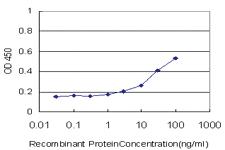 Anti-ALOX15 Mouse Monoclonal Antibody [clone: 3D8]